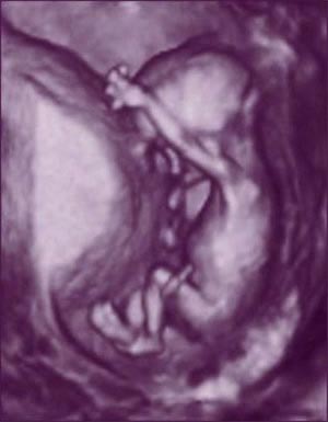 Nhìn tận mắt sự phát triển của bào thai (P2)