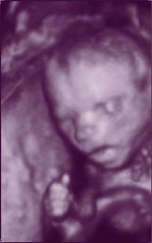 Nhìn tận mắt sự phát triển của bào thai (P3)