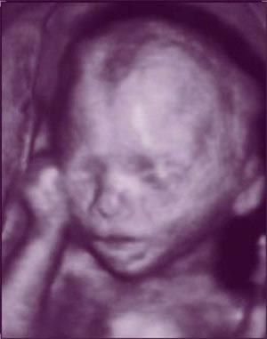 Nhìn tận mắt sự phát triển của bào thai (P3)