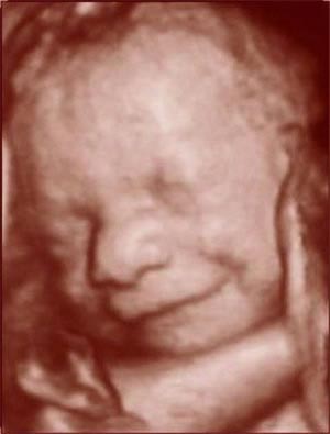 Nhìn tận mắt sự phát triển của bào thai (P4)