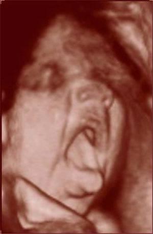 Nhìn tận mắt sự phát triển của bào thai (P4)