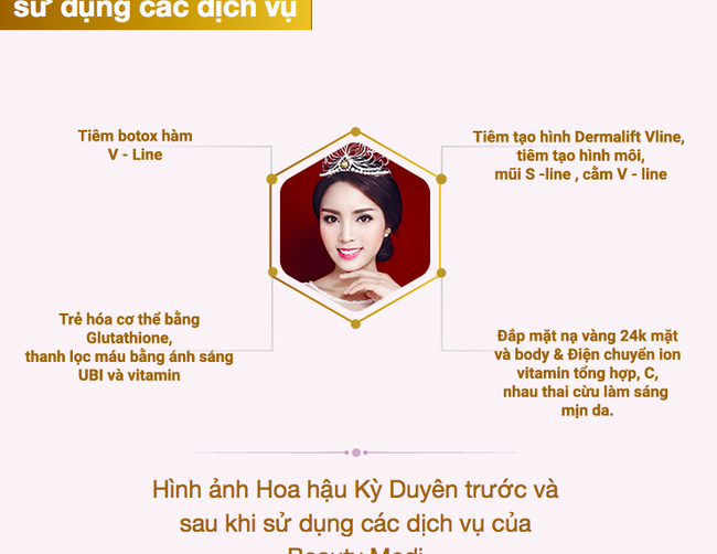 Thẩm mỹ viện đăng tải quảng cáo: Chiếc cằm nhọn hiện nay của Kỳ Duyên không phải là sản phẩm từ chúng tôi - Ảnh 2.