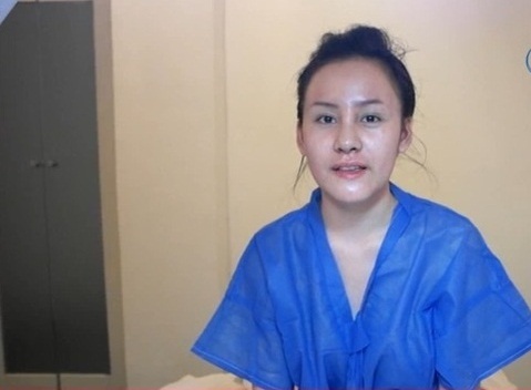 Bà Tưng Lê Thị Huyền Anh từng khiến nhiều người phải sốc với gương mặt nham nhở sau phẫu thuật thẩm mỹ