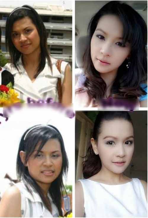 Gương mặt xinh đẹp của Thatmacha sau 3 tháng tu sửa nhan sắc ở Băngkok
