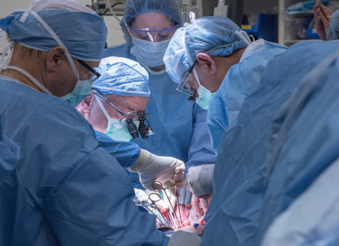 Các bác sĩ Bệnh viện Cleveland thực hiện cuộc phẫu thuật kéo dài chín giờ - Ảnh: Cleveland Clinic