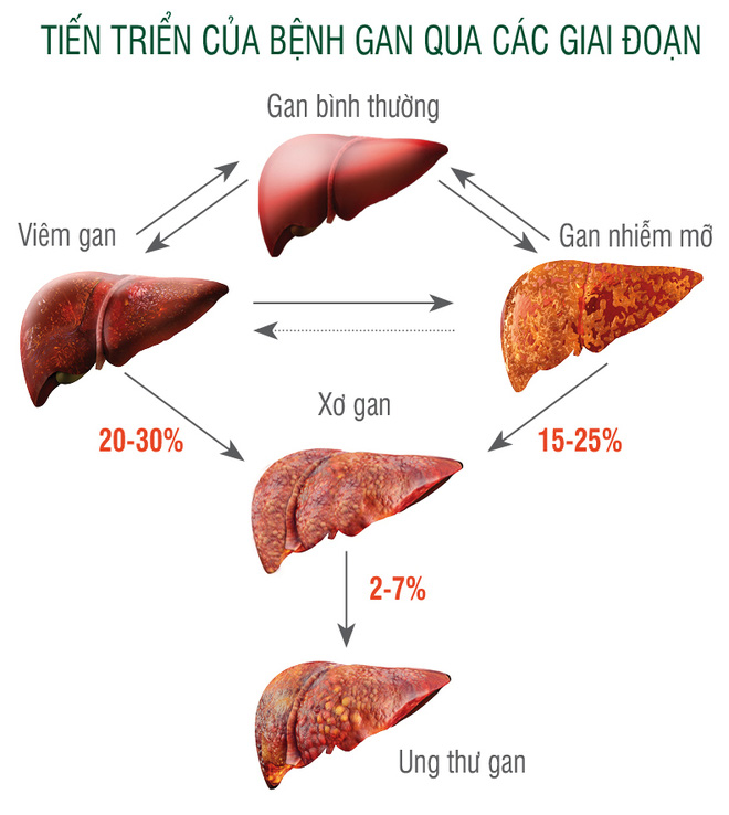 Bệnh nhân ung thư ân hận vì đã lơ là dấu hiệu chảy máu chân răng - Ảnh 2.