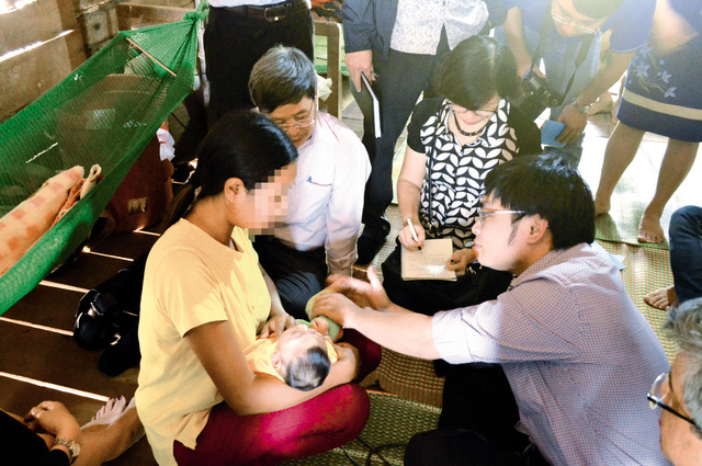Điều tra dịch tễ trường hợp trẻ mắc chứng đầu nhỏ tại huyện Krông Buk, Đắk Lắk. Ảnh: TL