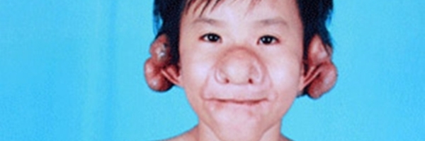 B&eacute; trai mắt 