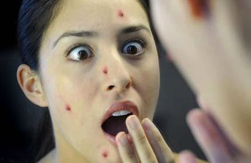 Ph&ugrave; mặt, nổi ban v&igrave;... chữa v&ocirc; sinh
