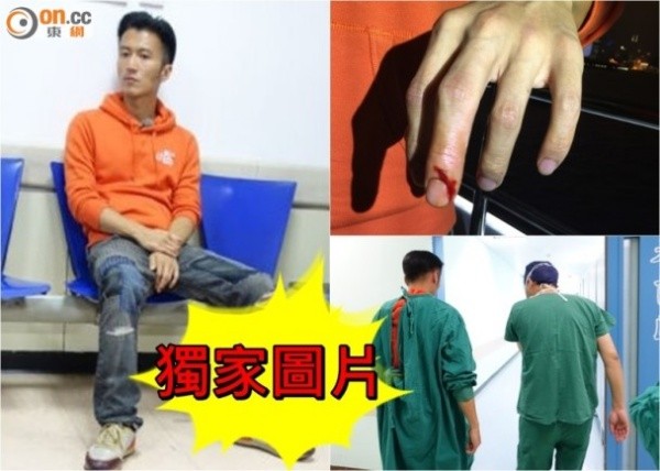 Tạ Đình Phong khoe ảnh bị thương ngón tay và đi kiểm tra ở viện.
