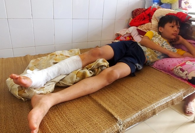 Một ch&aacute;u nhỏ bị bỏng đang điều trị tại bệnh viện. Ảnh: N. D.