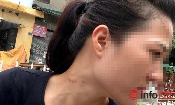 cô gái, phút thoát chết, tay thầy bói, tóc giả, Hà Nội cô gái, phút thoát chết, tay thầy bói, tóc giả, Hà Nội