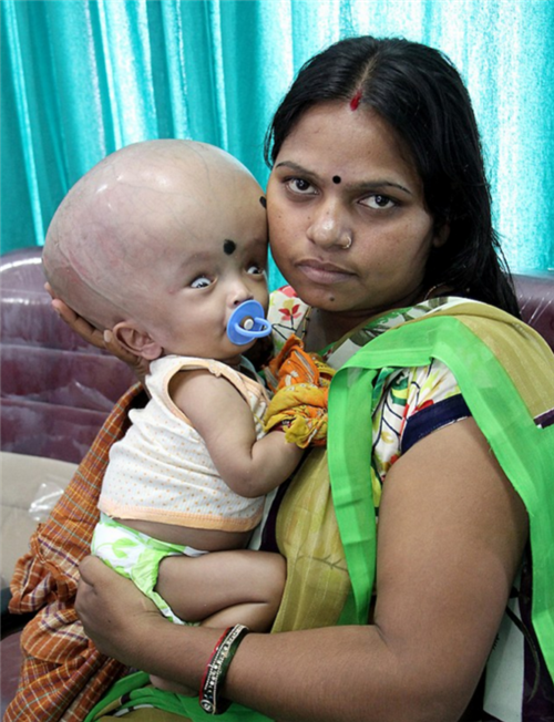 Em bé 4 tháng tuổi bị cả gia đình ruồng bỏ vì đầu quá to - Ảnh 4.