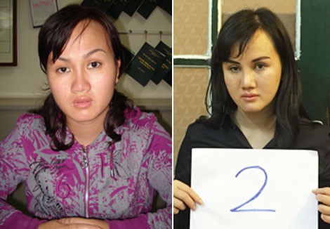 Nguyễn Phượng Ly trước và sau khi phẫu thuật thẩm mỹ.