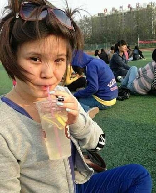 bi 'da', co gai hut mo lam xa phong tang ban trai hinh anh 1