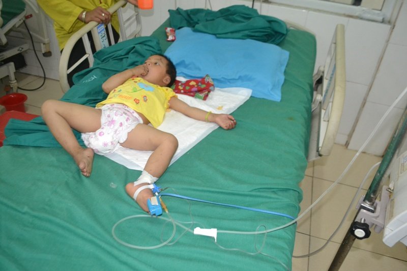 ha giang: be gai 3 tuoi bi dan ban xuyen dau hinh anh 1