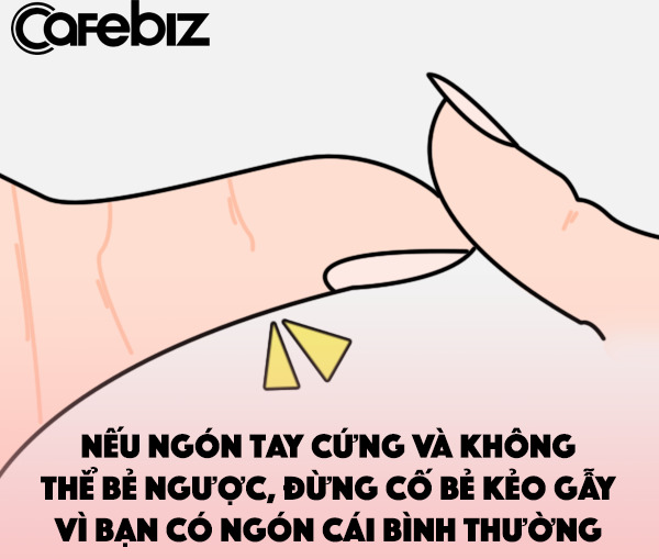 Ngón tay cái thông thường, không thể bẻ.