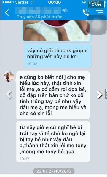 Đoạn chat qua lại giữa phụ huynh cháu bé và cô giáo.