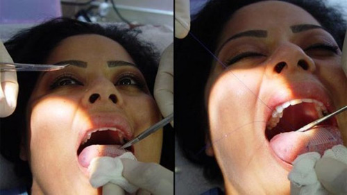 Mu&ocirc;n kiểu giảm c&acirc;n độc lạ tr&ecirc;n thế giới