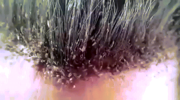 Đoạn video về chấy rận trên tóc khiến ai cũng phải nổi da gà