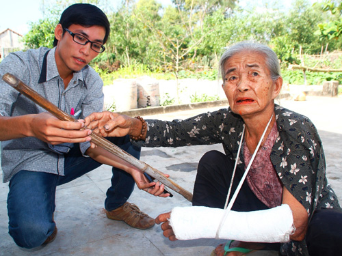 Mẹ 81 tuổi bị con g&aacute;i đ&aacute;nh g&atilde;y tay 1