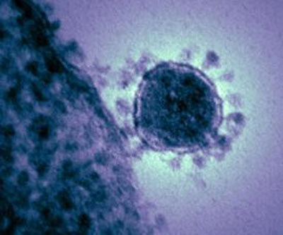 WHO kêu gọi cảnh giác với vi-rút mới giống bệnh SARS 1