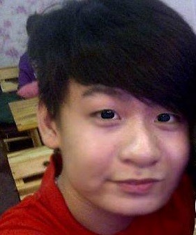 Teen boy Việt 17 tuổi công khai hình ảnh phẫu thuật thẩm mỹ 3 Teen boy Việt 17 tuổi công khai hình ảnh phẫu thuật thẩm mỹ 3