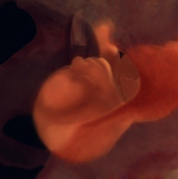 Tuần thai thứ 37: Sẵn sàng chào đón bé yêu 2