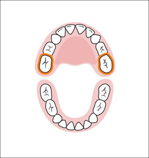 Thứ tự mọc răng sữa của bé mẹ cần biết 10