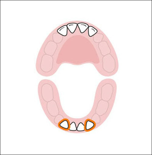 Thứ tự mọc răng sữa của bé mẹ cần biết 4