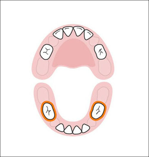 Thứ tự mọc răng sữa của bé mẹ cần biết 6