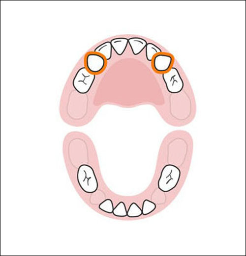 Thứ tự mọc răng sữa của bé mẹ cần biết 7