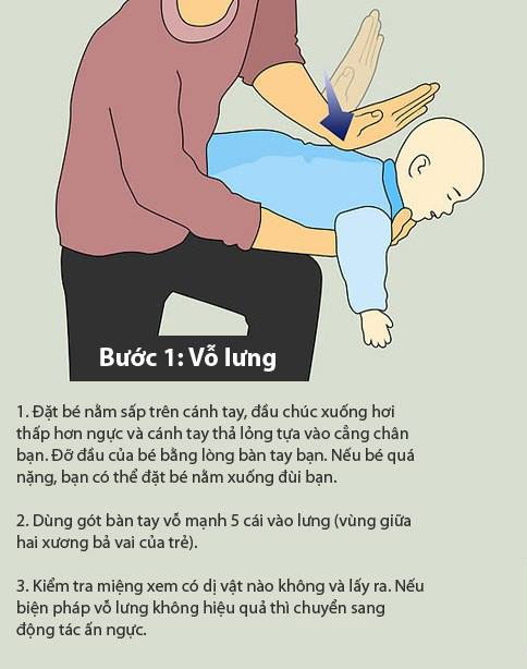 Những kỹ năng “vàng” cho mẹ khi trẻ bị hóc - sặc 2