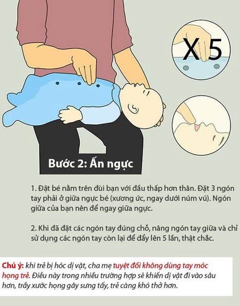 Những kỹ năng “vàng” cho mẹ khi trẻ bị hóc - sặc 3