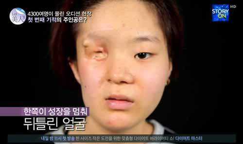 Giật mình gương mặt của cô gái sau phẫu thuật thẩm mỹ 2