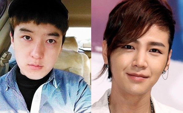 Phẫu thuật thẩm mỹ giống Jang Geun Suk để tưởng nhớ bạn gái 1