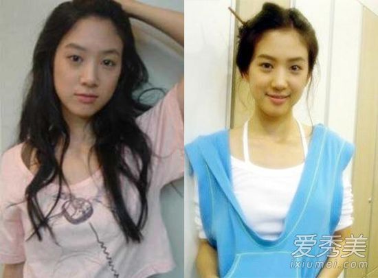 Jung Ryeo Won phẫu thuật thẩm mỹ 