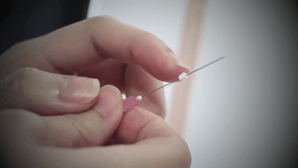 nâng mũi bằng chỉ nâng mũi bằng chỉ