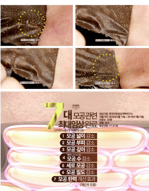 trị mụn đầu đen trị mụn đầu đen
