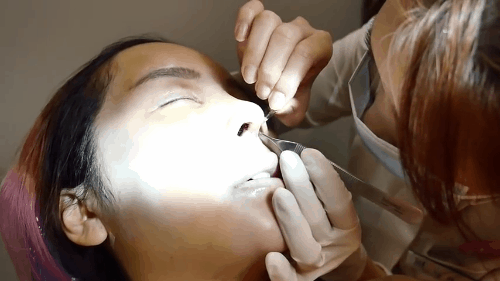 phẫu thuật thẩm mỹ phẫu thuật thẩm mỹ
