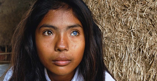 Cô gái có đôi mắt hai màu kỳ lạ ở Ninh Thuận 3