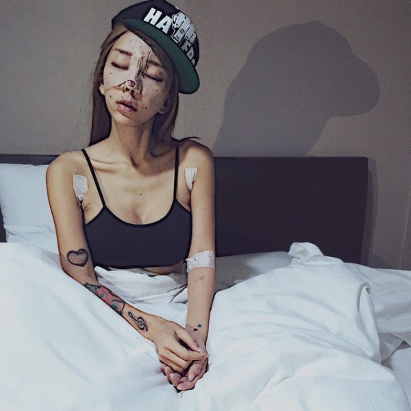 Nữ DJ nổi tiếng Malaysia c&ocirc;ng khai loạt ảnh phẫu thuật thẩm mỹ g&acirc;y sốc 5