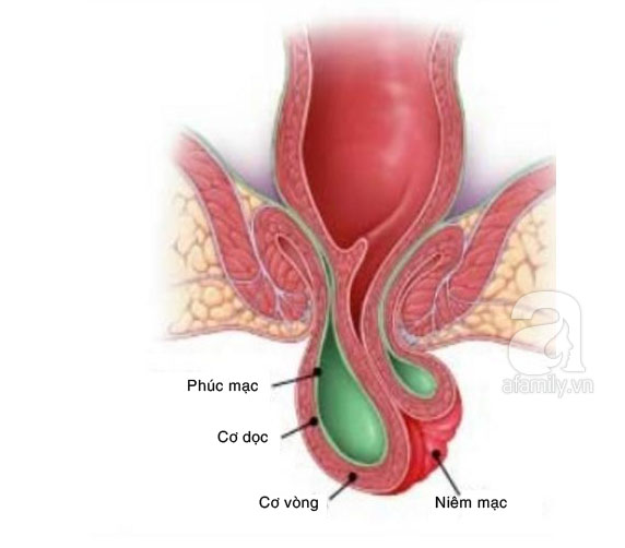 rắc rối ở hậu môn