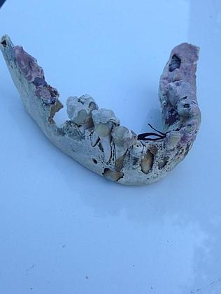 Bí ẩn xương hàm của em bé 1000 tuổi dạt vào bãi biển 1