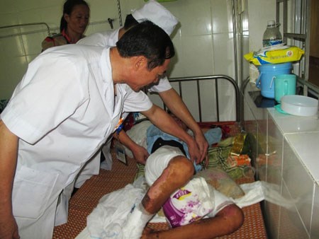 Nỗi ân hận của người mẹ đẩy con vào lửa đến nguy kịch 1 Nỗi ân hận của người mẹ đẩy con vào lửa đến nguy kịch 1