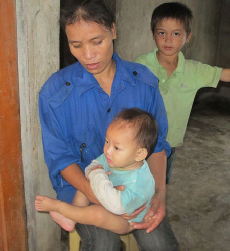 Nỗi ân hận của người mẹ đẩy con vào lửa đến nguy kịch 2 Nỗi ân hận của người mẹ đẩy con vào lửa đến nguy kịch 2