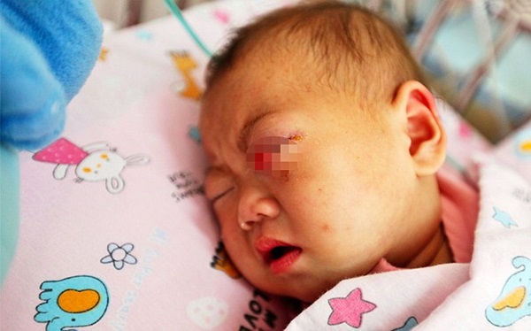 Quặn lòng bé gái 9 tháng tuổi bị cha chọc mù mắt_1 Quặn lòng bé gái 9 tháng tuổi bị cha chọc mù mắt_1