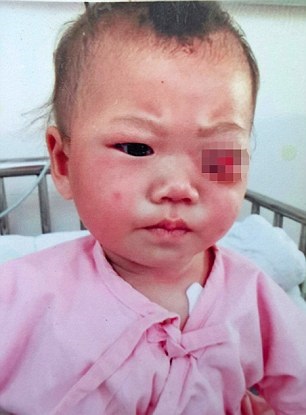 Quặn lòng bé gái 9 tháng tuổi bị cha chọc mù mắt_2 Quặn lòng bé gái 9 tháng tuổi bị cha chọc mù mắt_2