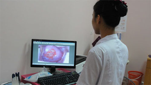 Li&ecirc;n tục bị vi&ecirc;m cổ tử cung  1