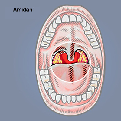 4 bộ phận 